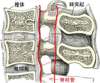 脊柱管狭窄症画像