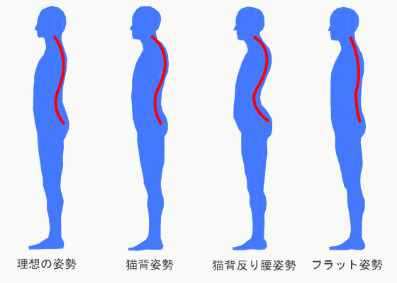 姿勢と背骨（脊柱）の湾曲